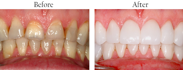 dental images 11364